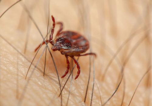 Tick parasite on a person